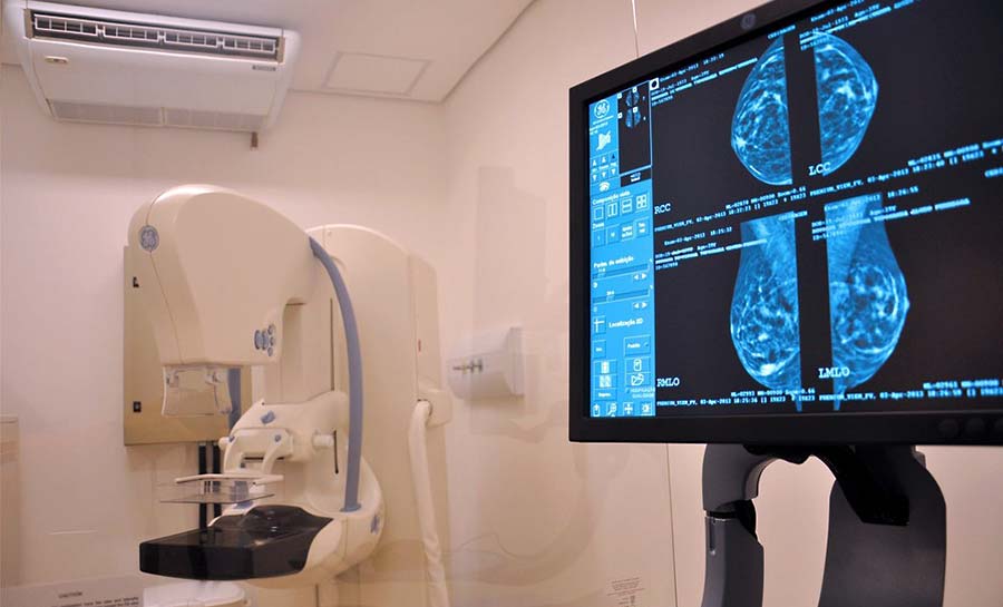 Mais de 1,4 mil resultados de mamografias aguardam retirada no Cecon em Rio Branco
