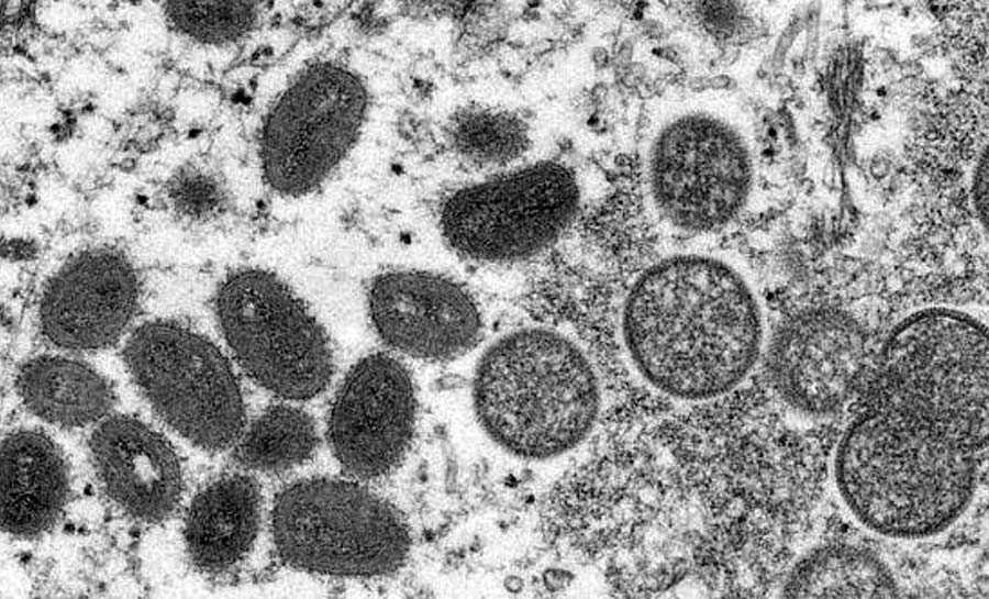 Brasil investiga quarto caso suspeito de varíola dos macacos