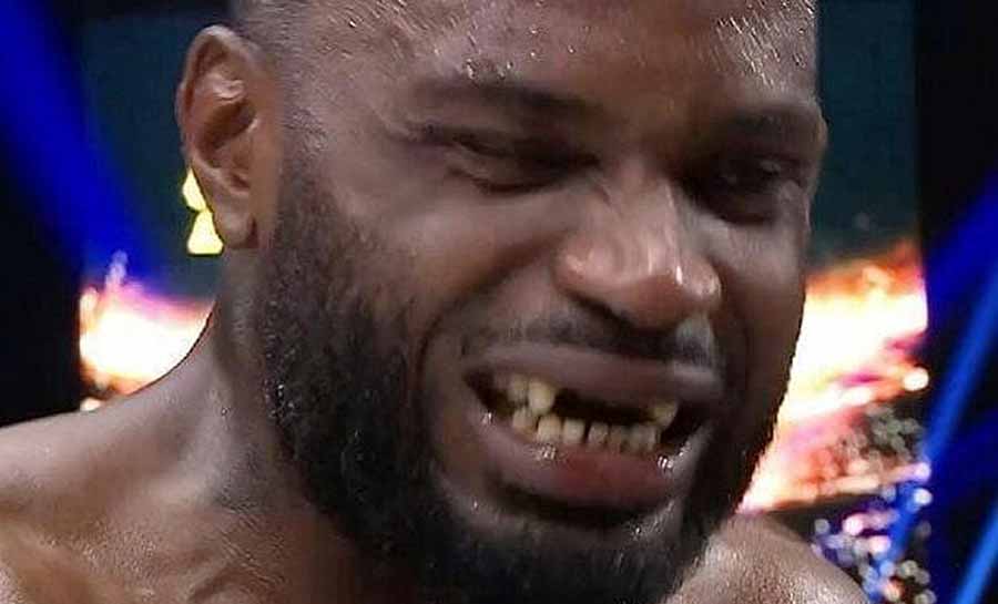 MMA: Lutador perde os dentes após sequência de socos