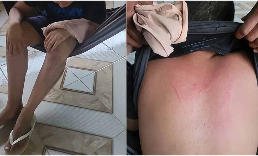 Pai denuncia vizinho policial penal por agressão a filho autista no interior do Acre