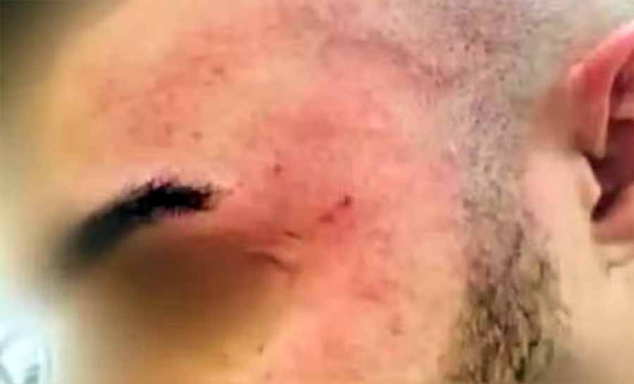 Médico é agredido com tapa no rosto por pai de criança durante atendimento em hospital do Acre