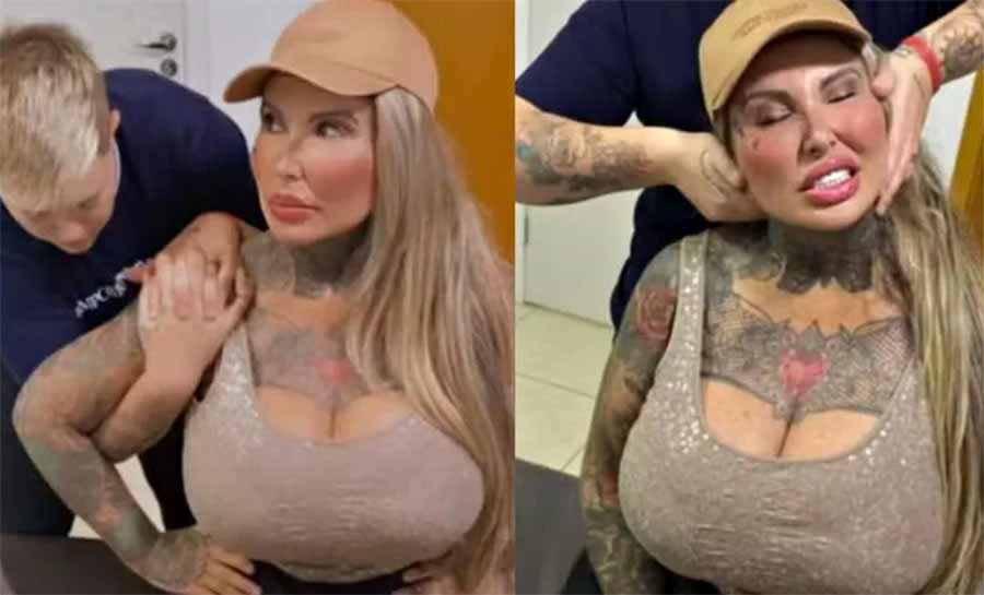 Sabrina Boing Boing trava coluna após próteses de silicone de 6 litros