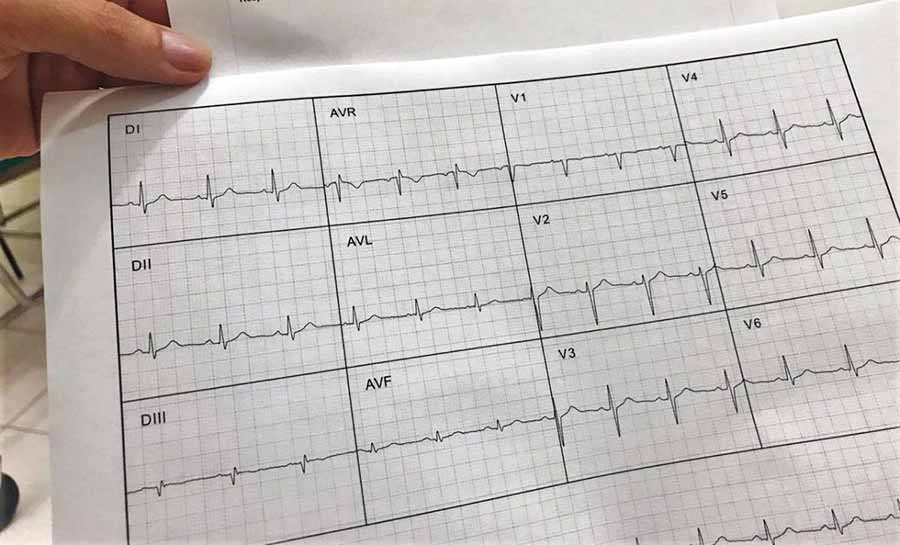 Com laudo de eletrocardiograma emitido em tempo real, Fundhacre reduz espera dos pacientes de 15 dias para 20 minutos
