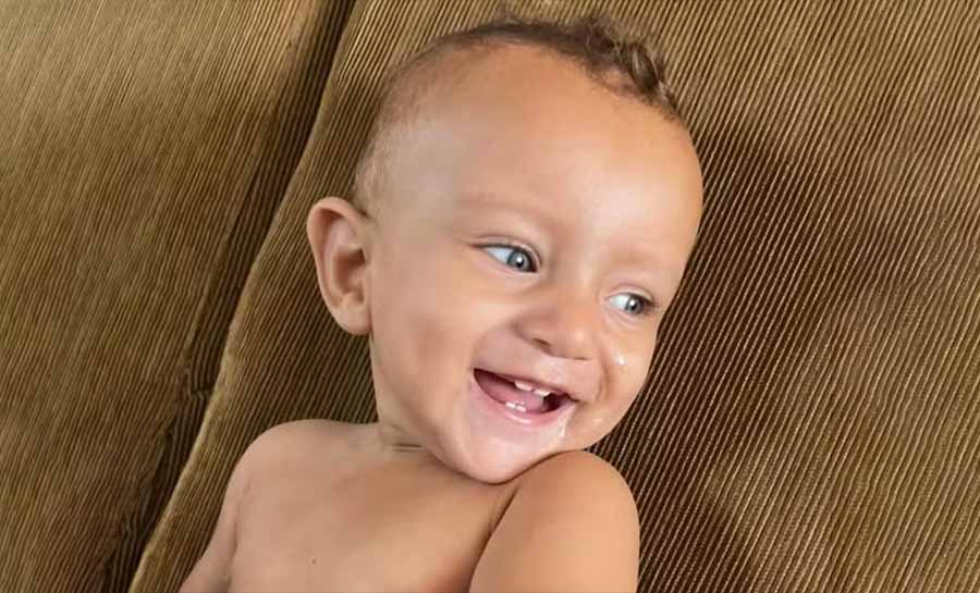 Bebê de 11 meses morre após ser atingido por panela com brigadeiro e sofrer queimaduras de 2º grau no AC