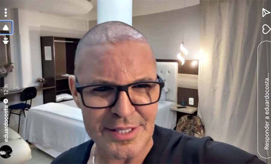 Eduardo Costa explica queda de cabelo: “ Usei muita bomba”