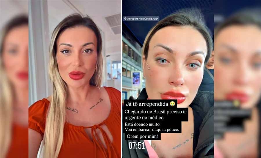 Andressa Urach relata dor intensa após mudar cor dos olhos