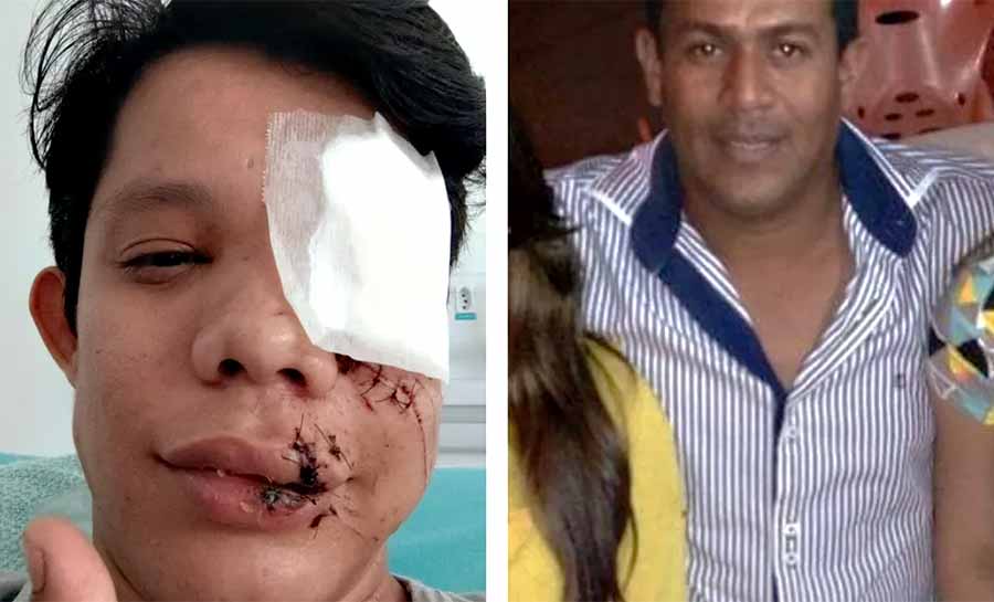 Empresário é condenado a pagar R$ 50 mil a professor que perdeu olho após agressão em bar no AC