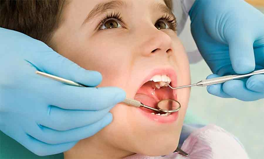 Cárie infantil: como prevenir desde os primeiros dentinhos