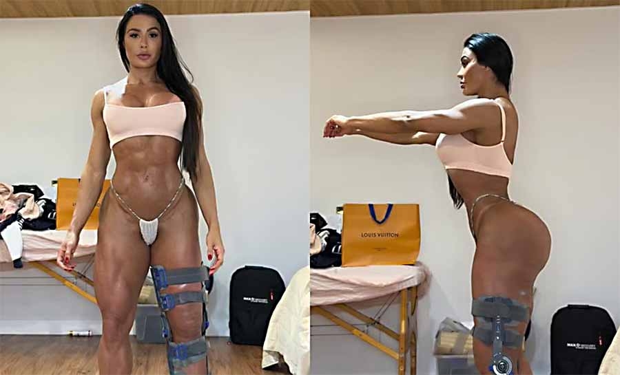 Gracyanne Barbosa exibe o corpo após lesão no “Dança dos Famosos”