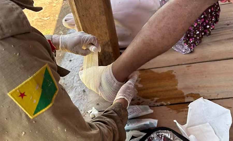 Homem é picado no pé por jararaca ao ir tomar banho em rio no interior do AC